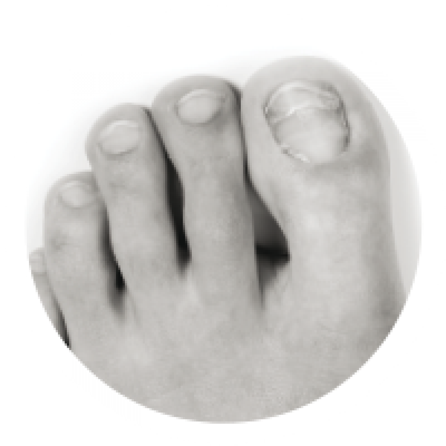 athletes-foot-fungal-nail-conditions, Dalkey Podiatry Clinic can help